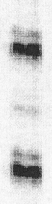 Przyk³adowe wyniki ukazuj¹ce utratê heterozygotycznoœci.