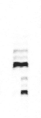 dotycz¹ wielu obszarów chromosomalnych.