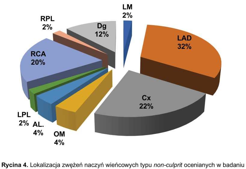 Zwężenia typu non-culprit, podlegające pomiarowi FFR zlokalizowane były najczęściej w LAD. W dalszej kolejności dotyczyły one gałęzi okalającej (ang.