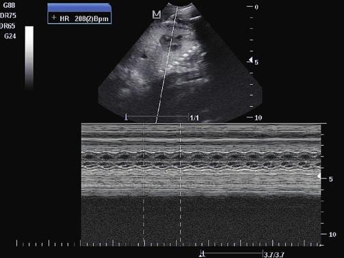 twarde) i kotów jest głowica mikrokonweksowa pracująca w zakresie częstotliwości 5-10 MHz.