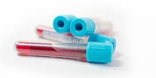 aktywność fizyczna stężenie cholesterolu LDL wczesne występowanie ChNS w rodzinie stres stężenie cholesterolu