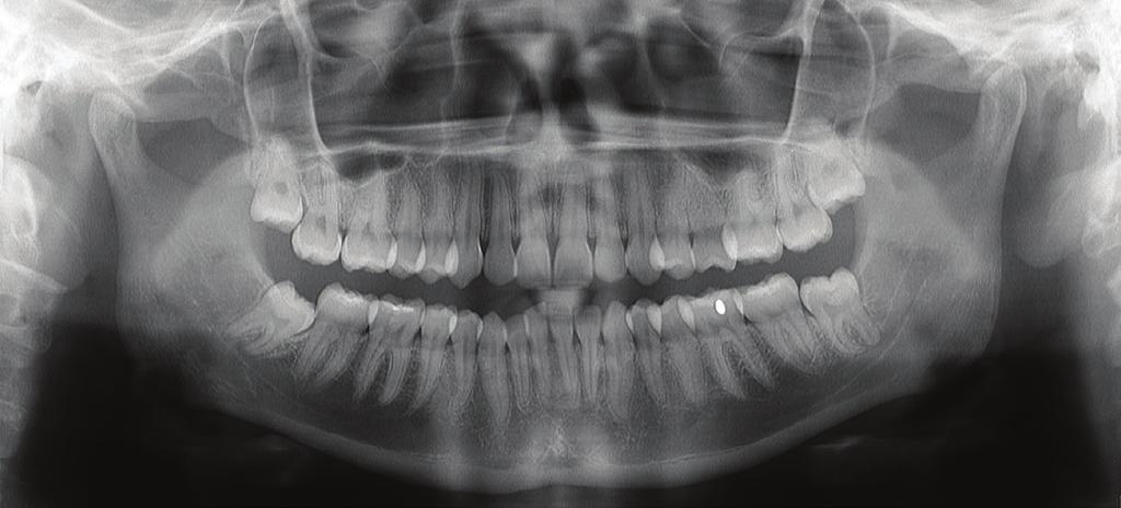 pediatryczne i panoramiczne z segmentacją, boczne projekcje stawu skroniowo-żuchwowego