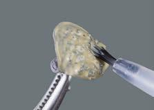 OPAQUE PASTE obróbka Wskazówka: strzykawkę ze światłoczułym OPAQUE PASTE po użyciu natychmiast zamknąć, wcześniej cofając materiał co najmniej jednym obrotem tłoczka.