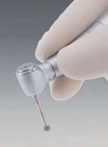 degranulation kit CHIRURGIA I IMPLANTOLOGIA Zestaw do bezpiecznego i efektywnego usuwania tkanki ziarninowej dokładne odpreparowanie i usunięcie tkanek miękkich Zestaw 4 wierteł firmy Strauss & Co.