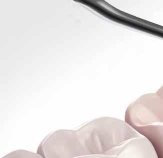 prewencja periimplantitis oraz periimplant mucositis W 80% przypadków zdrowych implantów występuje zapalenie dziąsła.