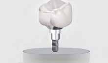 Podczas reakcji antybakteryjnej SilverPlug nie uwalnia żadnych związków chemicznych.