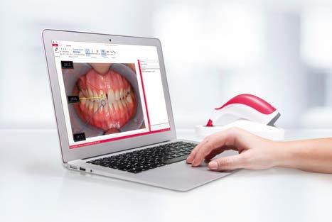 Wszystkie istotne informacje dotyczące koloru zębów, a także zdjęcia pacjentów mogą być wysyłane smartfonem lub tabletem. VITA Assist.