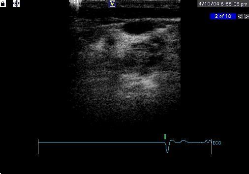 Ultrasonografia uciskowa minimum 4