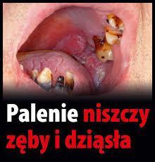 Ustawa z dnia 09 listopada 1995 o ochronie zdrowia przed następstwami używania tytoniu i wyrobów tytoniowych. (t.j. Dz. U. z 1996 r. nr 10 poz. 55) Art. 6.1. Zabrania udostępniana wyrobów tytoniowych, papierosów elektronicznych lub pojemników zapasowych osobom do lat 18.