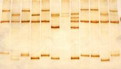 różne układy konformerów A B C D różne układy konformerów AB A B DNA MIKROSATELITARNY VNTR (ang. Variable Number of Tandem Repeats) sekwencje o zmiennej liczbie tandemowych powtórzeń. STR (ang.