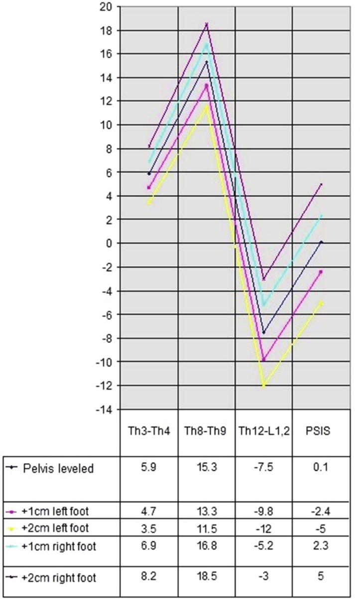 Figure 1. The difference of the angle of trunk rotation in patients with idiopathic scoliosis in a simulation of limb length discrepancy.