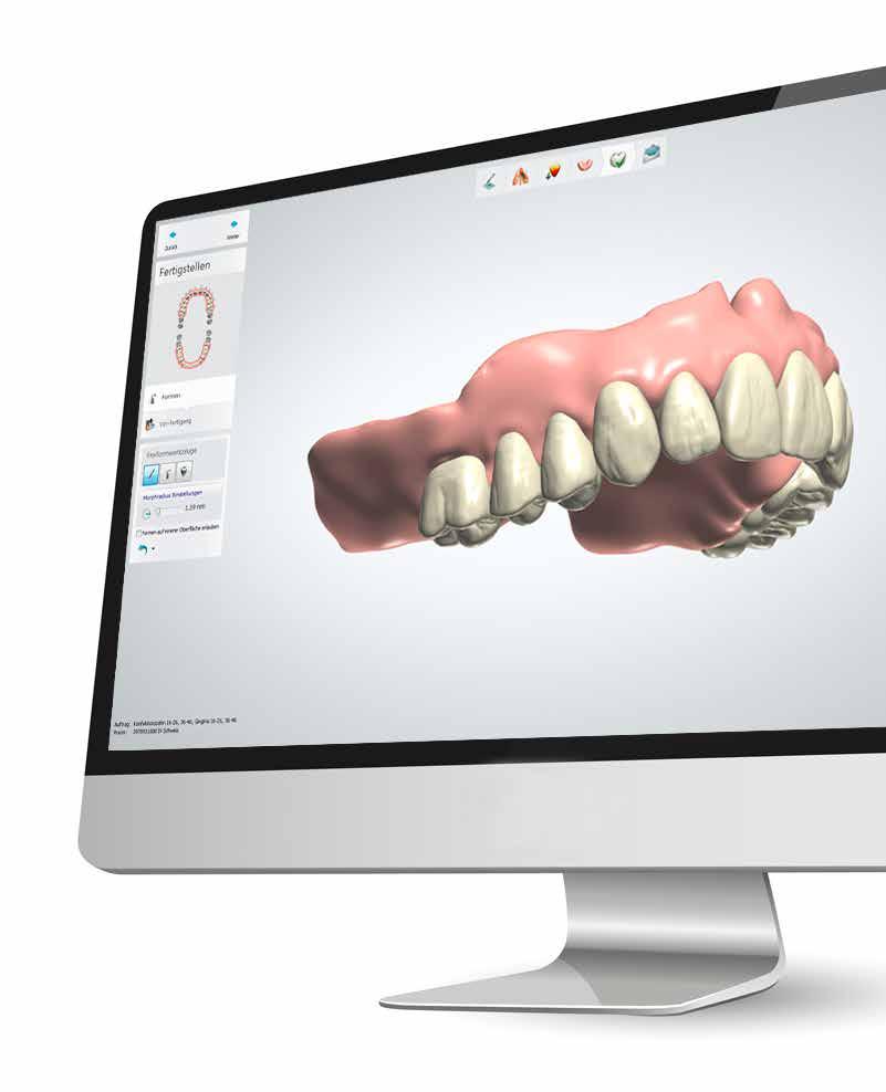 DIGITAL DENTURE Szybki monolityczny proces Digital Denture jest to kompletny cyfrowy proces wytwarzania protez bezzębia.