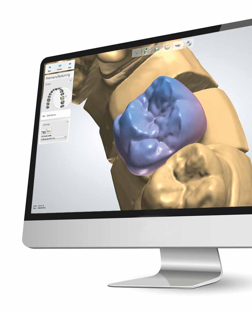 PROGRAM DO PROJEKTOWANIA 3SHAPE DENTAL SYSTEM Wydajność, na której możesz polegać Dzięki wysokiej wydajności programu CAD 3Shape Dental System użytkownik otrzymuje efektywne narzędzie do