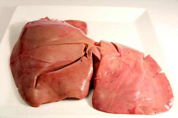 TRANSPLANTACJA WĄTROBY Wszczepienie biorcy wątroby pochodzącej od