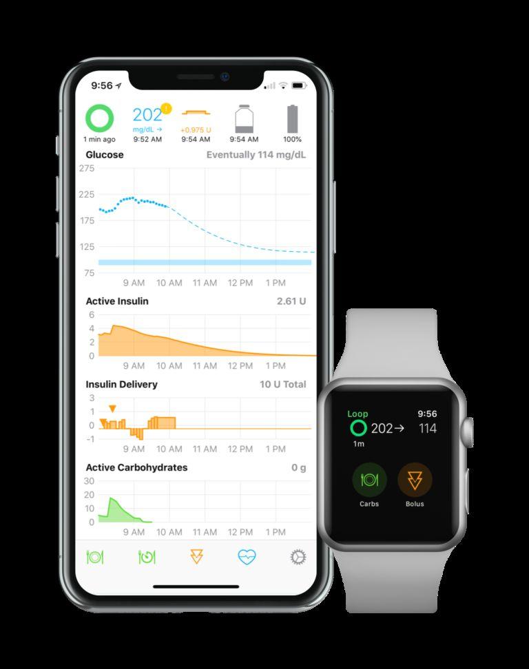 OpenAPS Loop