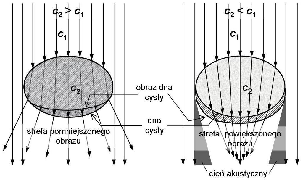 Ćwiczenie nr 3 Temat: Ultrasonografia. Pomiary parametrów ultrasonografu. 1. Zapoznać się z budową, zasadą działania ultrasonografów Abdoscan 5 z głowicą liniową oraz DUS- 101 z głowicą sektorową. 2.