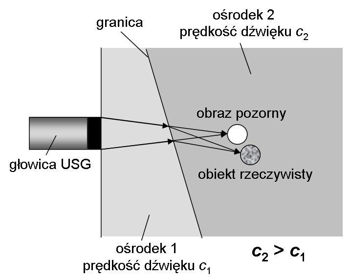 Przeprowadzić testowanie poprawności parametrów obrazu ultrasonografu Abdoscan 5 na wybranym obiekcie testującym dla prezentacji typu A i B.