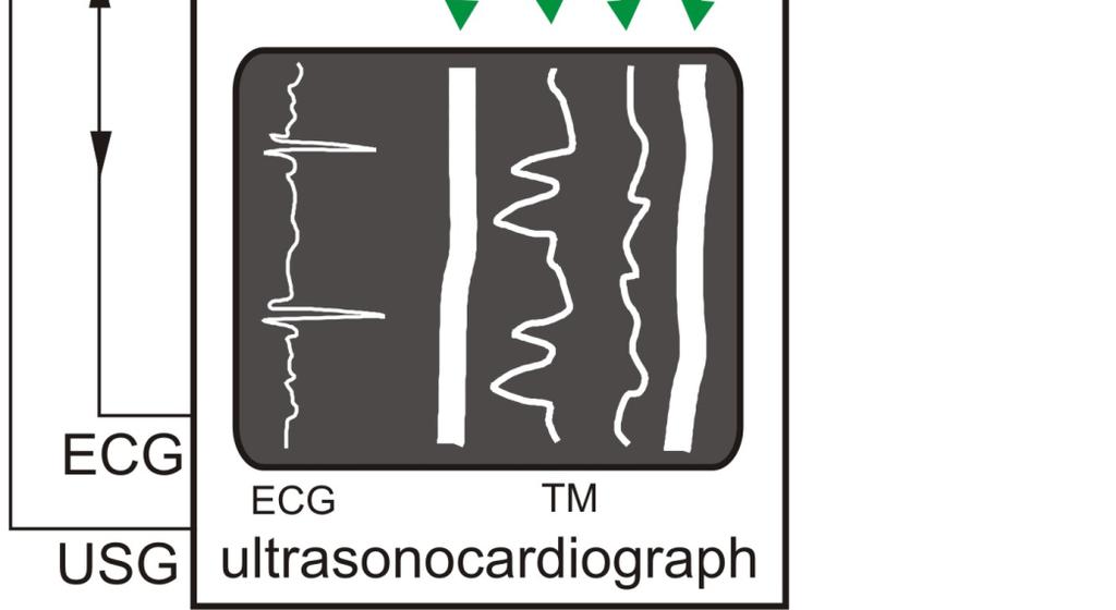 Gudra, A computer-controlled phantom of the heart valve movement designed for ultrasonic examinations, Revista de Acustica, 38(3/4), 2007. * 3. Wiadomości z wykładu. 4. J.