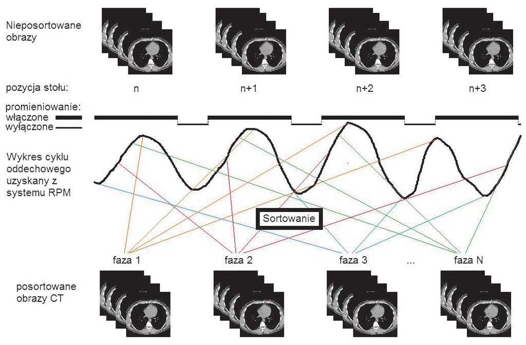 radiologia \ radiology artykuł naukowy \ scientific paper minut, zostały stworzone sekwencje dynamiczne.