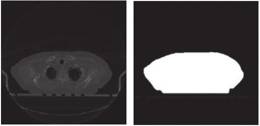 artykuł naukowy / scientific paper radiologia / radiology Smart Deviceless4D Z aplikacją Smart Deviceless4D nie jest dostarczany żaden specjalny marker.