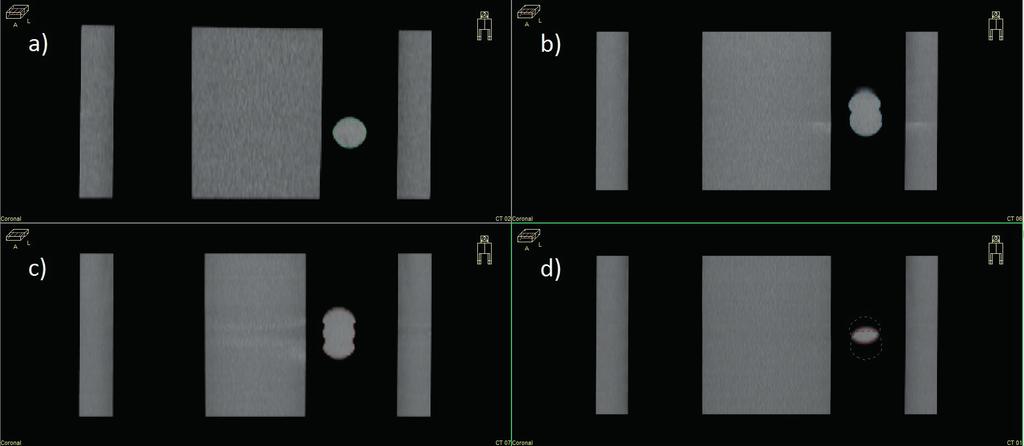 radiologia \ radiology artykuł naukowy \ scientific paper Materiały i metodyka Grupa badawcza Porównanie systemów Smart Deviceless4D i RPM/Advantage4D oparto na badaniach obrazowych grupy sześciu