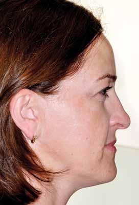 leczenia Zdjęcia zewnątrzustne: a) en face, b) en face