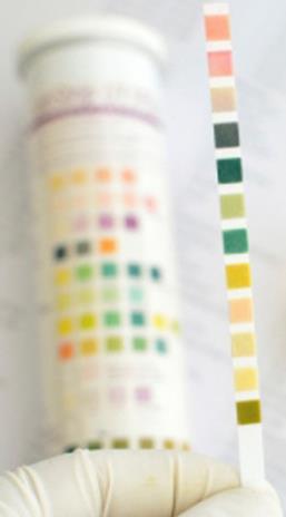 Esteraza leukocytarna Enzym produkowany w neutrofilach Zanieczyszczenie próbki krwią zaburza odczyt testu!