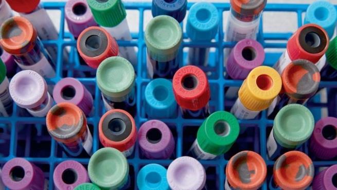 Diagnostyka Za 85%; Przeciw 13%; wstrzymało się 2% Poziom wiarygodności:
