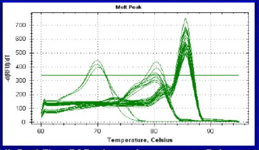 4. Transkryptomika: metody, Real Time PCR. Real Time PCR, qpcr: reakcja PCR pozwalająca na pomiar ilości powstałego produktu PCR w czasie rzeczywistym. Real Time-PCR vs.