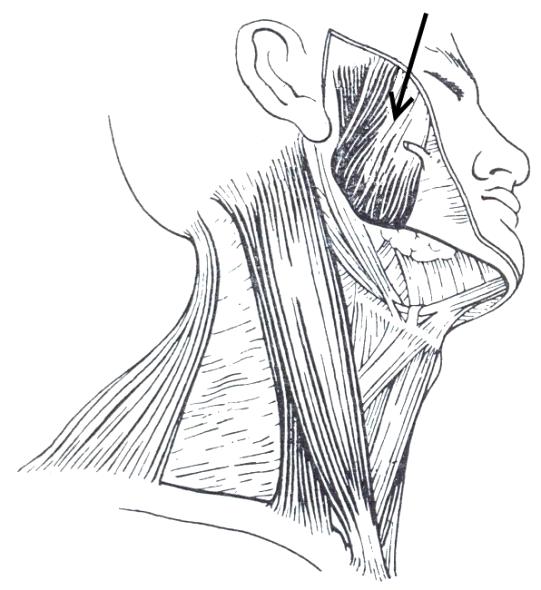 Na rysunku przedstawiającym czaszkę noworodka strzałką zaznaczono szew strzałkowy. szew ciemieniowy.