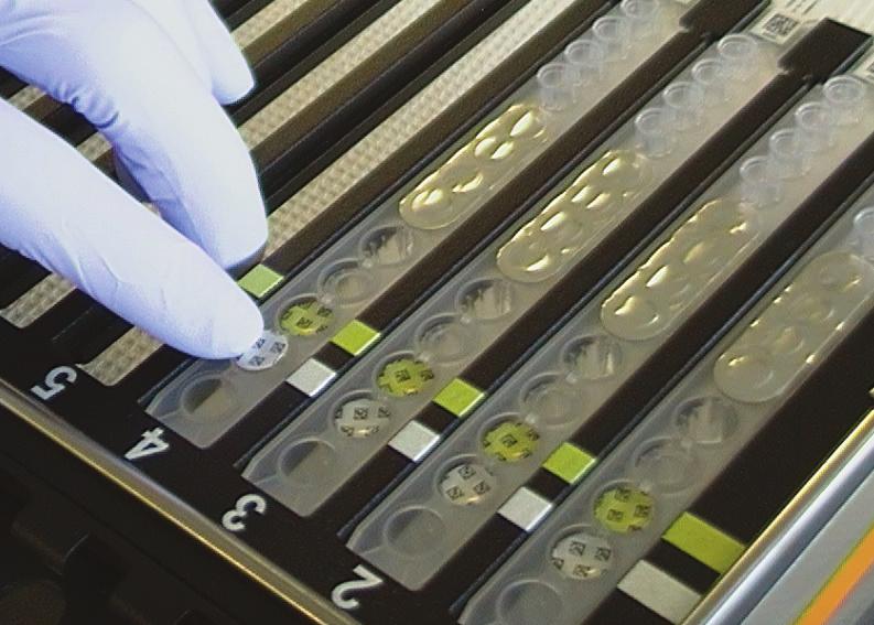 Przygotowanie próbek 1. Worteksować wzbogaconą próbkę na podłożu Lim Broth, aby uzyskać jednolitą dystrybucję. 2.