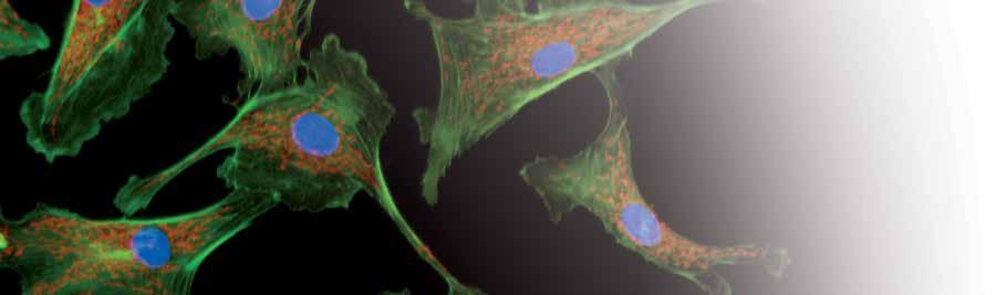 Poznaj zasady funkcjonowania płytek ibidi podczas obserwacji żywych komórek Wybierz odpowiedni do swoich badań rozmiar i