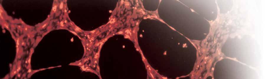 Angiogeneza Obserwacje procesu tworzenia rurkowatych struktur naczyń krwionośnych w