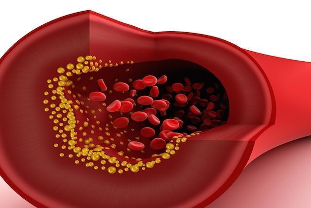 (cholesterol endogenny) lub dostarczany z pokarmem (cholesterol