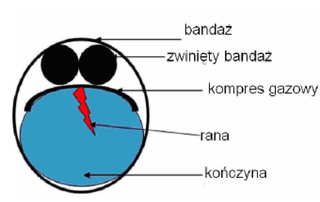 Krwotok żylny charakteryzuje się:: równomiernym wydobyciem krwi z rany, zabarwieniem ciemnoczerwonym.
