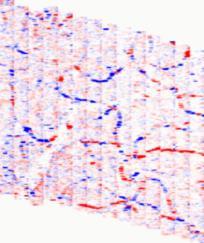Mapy prędkości przepływu krwi w naczyniach włosowatych siatkówki, uzyskane metodą STdOCT (joint spectra and time domain OCT). ii - v.
