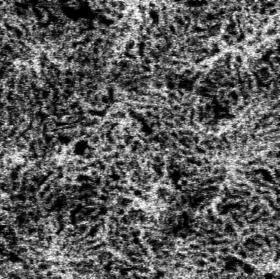 a b. c d e f g Flow fill factor = 0.65 Rys.13. Wyznaczanie współczynnika wypełnienia przepływem. a. Projekcja en face choriocapillaris. b. Konstrukcja filtru przestrzennego (kolor zielony) z wykorzystaniem radialnego widma mocy.