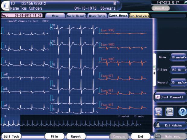 Niezawodny Technologia analizy przebiegów EKG wysokiej klasy firmy Nihon Kohden spełnia wymogi międzynarodowego standardu IEC60601-51 dla