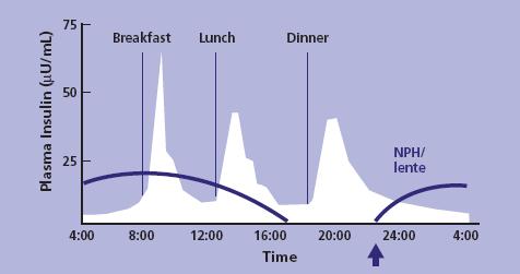 insulinemia Model odtworzenia profilu insulinemii podstawowej - NPH śniadanie objad kolacja Insulina NPH American