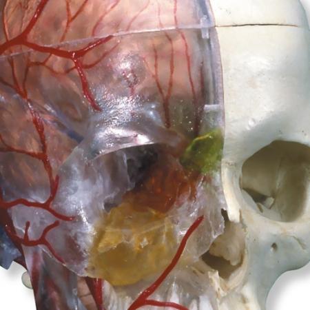 Prezentuje schematycznie dopływ krwi do czaszki (zatoka opony twardej), tętnice twarzowe i szyjne (tętnica szyjna wspólna,
