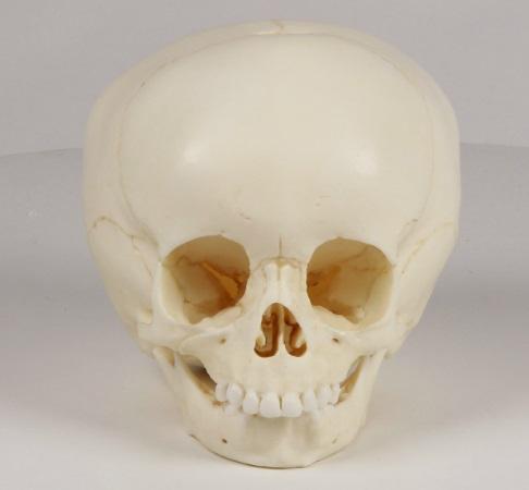 Model czaszki 15-miesięcznego dziecka Nr ref: MA01039 Informacja o produkcie: "Model czaszki