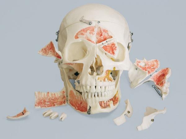 W przekroju horyzontalnym zaprezentowano jamę czaszki, wewnątrz której kolorem oznaczono przebieg naczyń oponowych, zatoki żylnej oraz tętnicy szyjnej wewnętrznej.