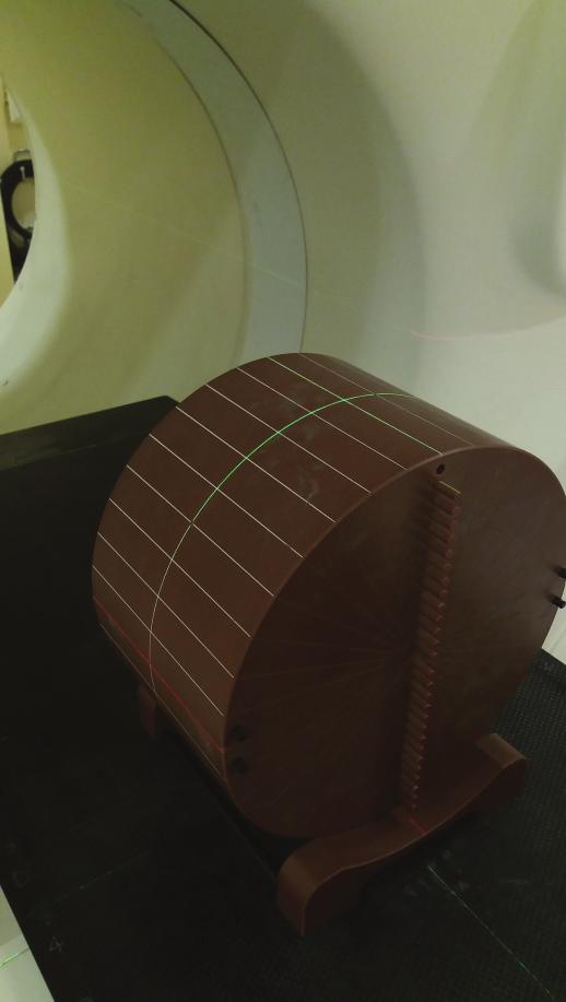 Słowa kluczowe: tomoterapia, megawoltowa tomografia komputerowa, kontrola jakości, ARTISCAN Keywords: tomotherapy, megavoltage computed tomography, quality assurance, ARTISCAN Wstęp Kontrola jakości