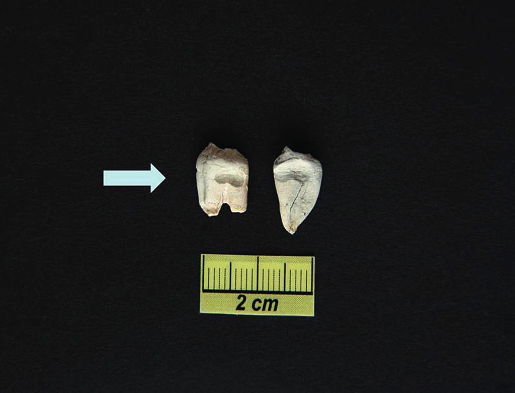 Analiza antropologiczna szczątków kostnych pochodzących z grobu skrzynkowego.