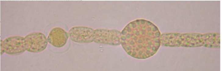 diazotroficzne (Anderson,