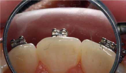 POSITIONING AND ORTHODONTIC