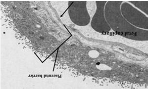 do syncytiotrofoblastu zmniejszenie grubości syncytiotrofoblastu niekiedy