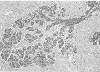 białkowych (gonadotropiny łożyskowe, laktogen łożyskowy, relaksyna) immunoglobuliny