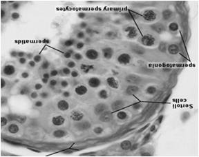 nabłonek plemnikotwórczy Komórki plemnikotwórcze: