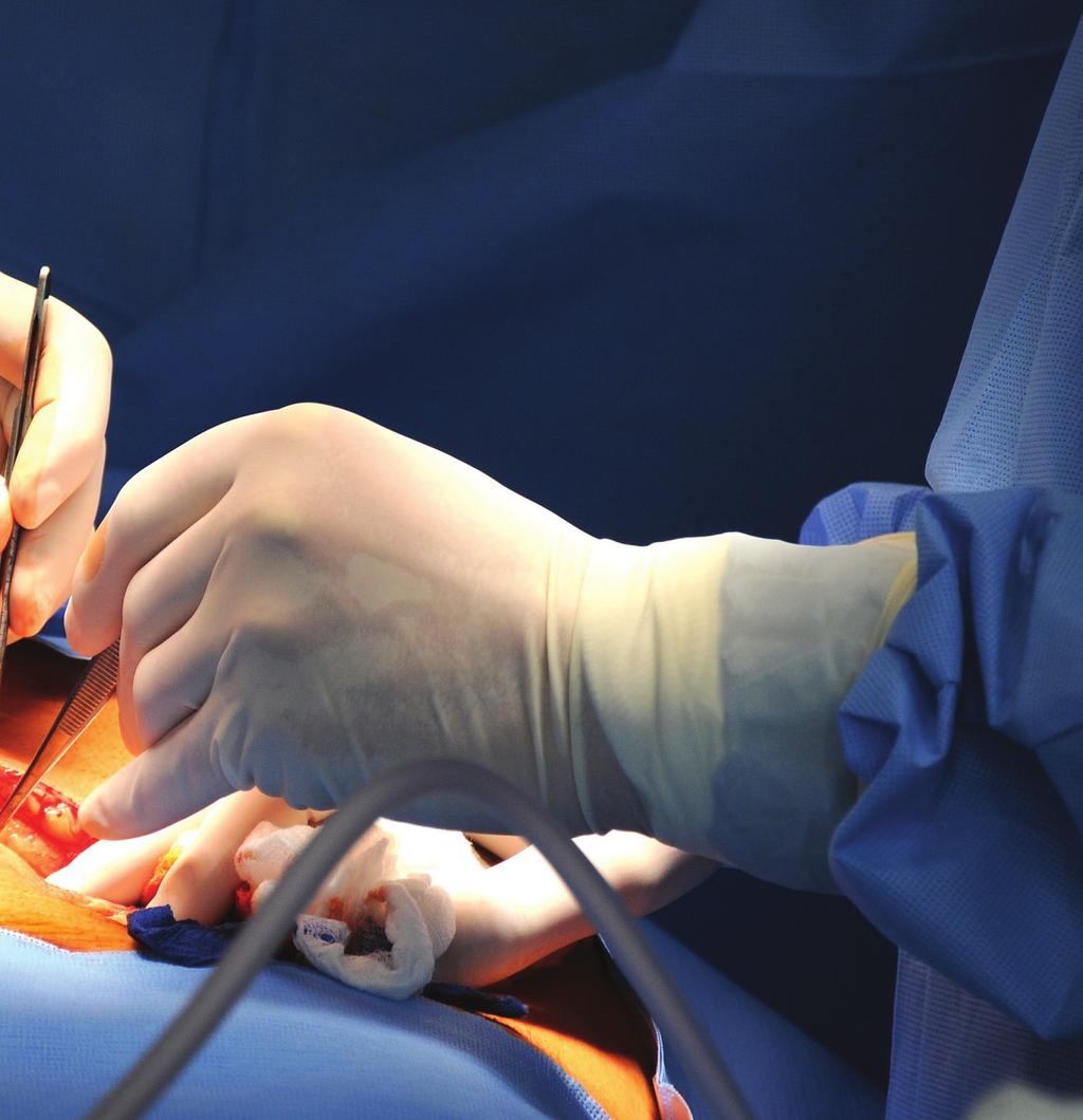 27 Rękawice chirurgiczne to sterylny wariant rękawiczek medycznych o anatomicznej budowie, przeznaczonych do zabiegów inwazyjnych jałowych warunków oraz wysokiej precyzyjności.